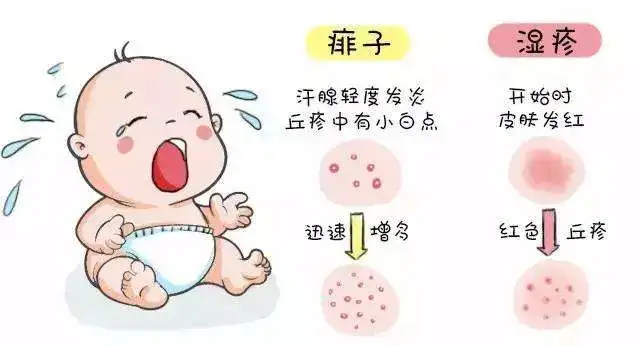 湿疹.jpg 湿疹.jpg